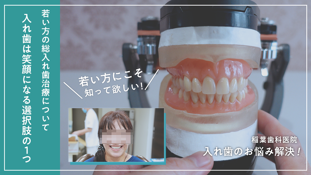若い方の総入れ歯治療について【YouTubeチャンネル更新】