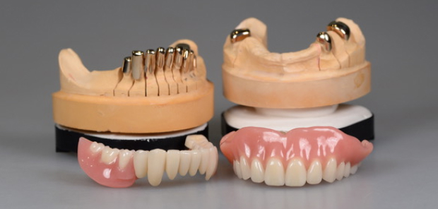 ドイツ式入れ歯、 テレスコープ義歯の種類について