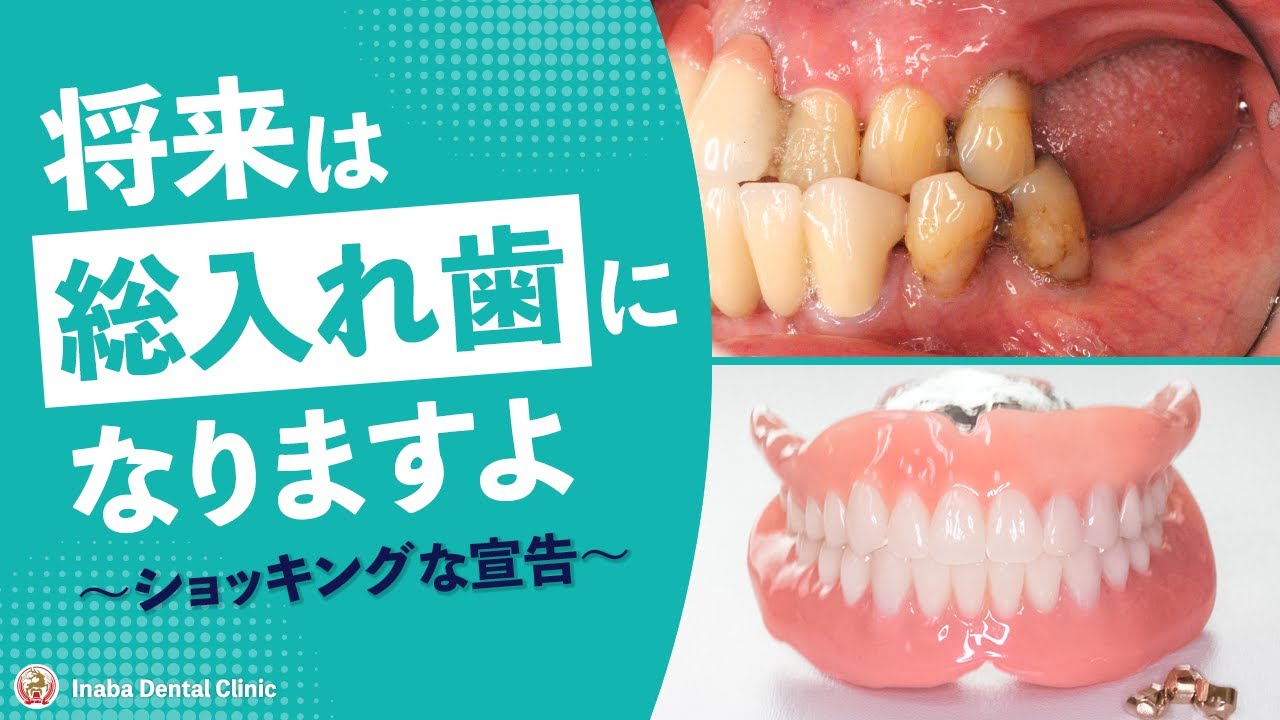 【YouTube】将来は総入れ歯になりますよ〜ショッキングな宣告〜