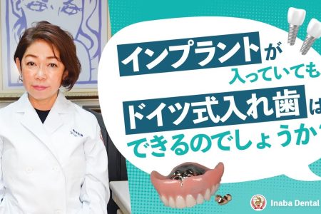 【YouTube】インプラントが入っていても、ドイツ式入れ歯はできるのでしょうか？