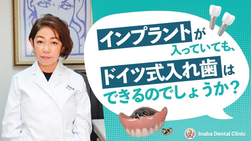 【YouTube】インプラントが入っていても、ドイツ式入れ歯はできるのでしょうか？