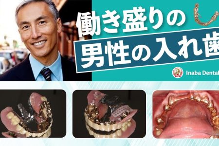 【YouTube】働き盛りの男性の入れ歯について