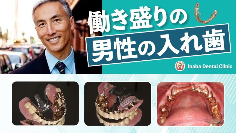 【YouTube】働き盛りの男性の入れ歯について