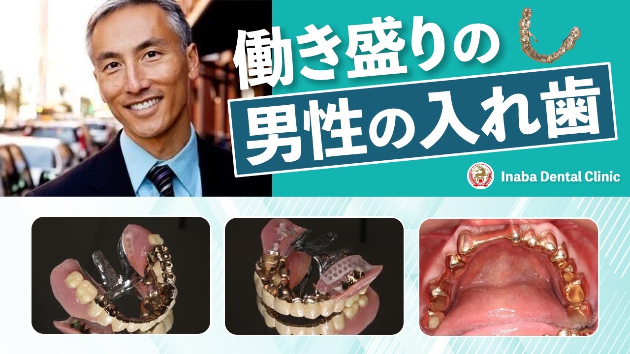 【YouTube】働き盛りの男性の入れ歯について