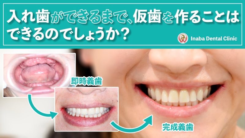 【YouTube】入れ歯ができるまで、仮歯を作ることはできますか？